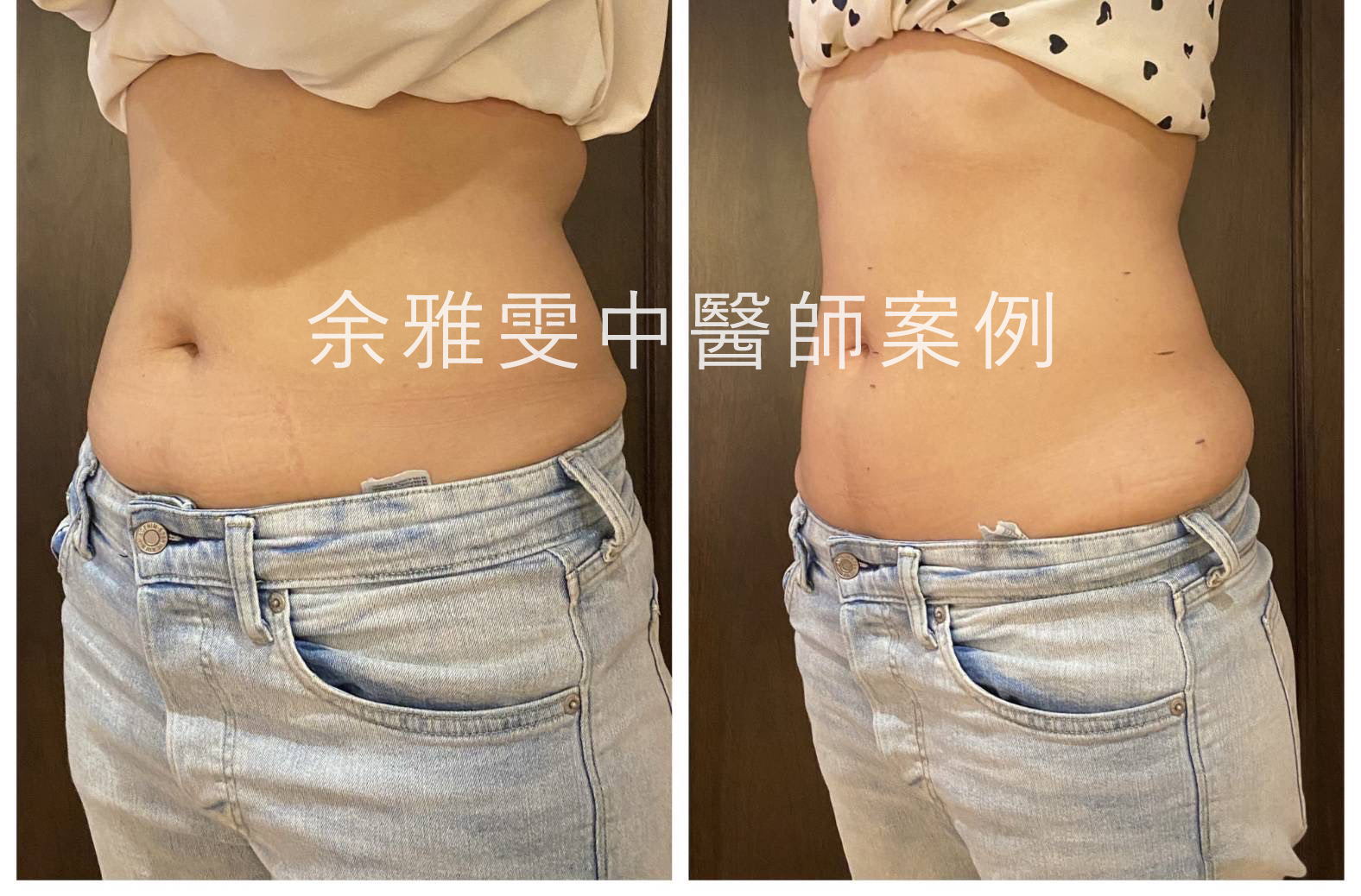 黃太太的肚子1
